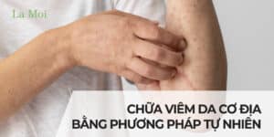 CHỮA VIÊM DA CƠ ĐỊA BẰNG PHƯƠNG PHÁP TỰ NHIÊN