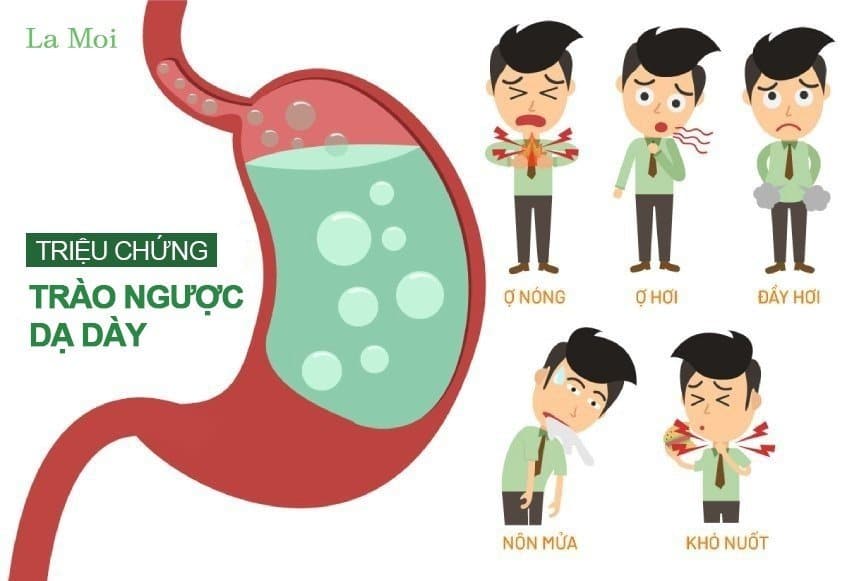 Triệu chứng của trào ngược dạ dày