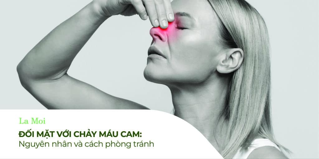 đối mặt với chảy máu cam: nguyên nh n và cách phòng tránh