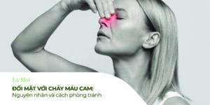 đối mặt với chảy máu cam: nguyên nh n và cách phòng tránh