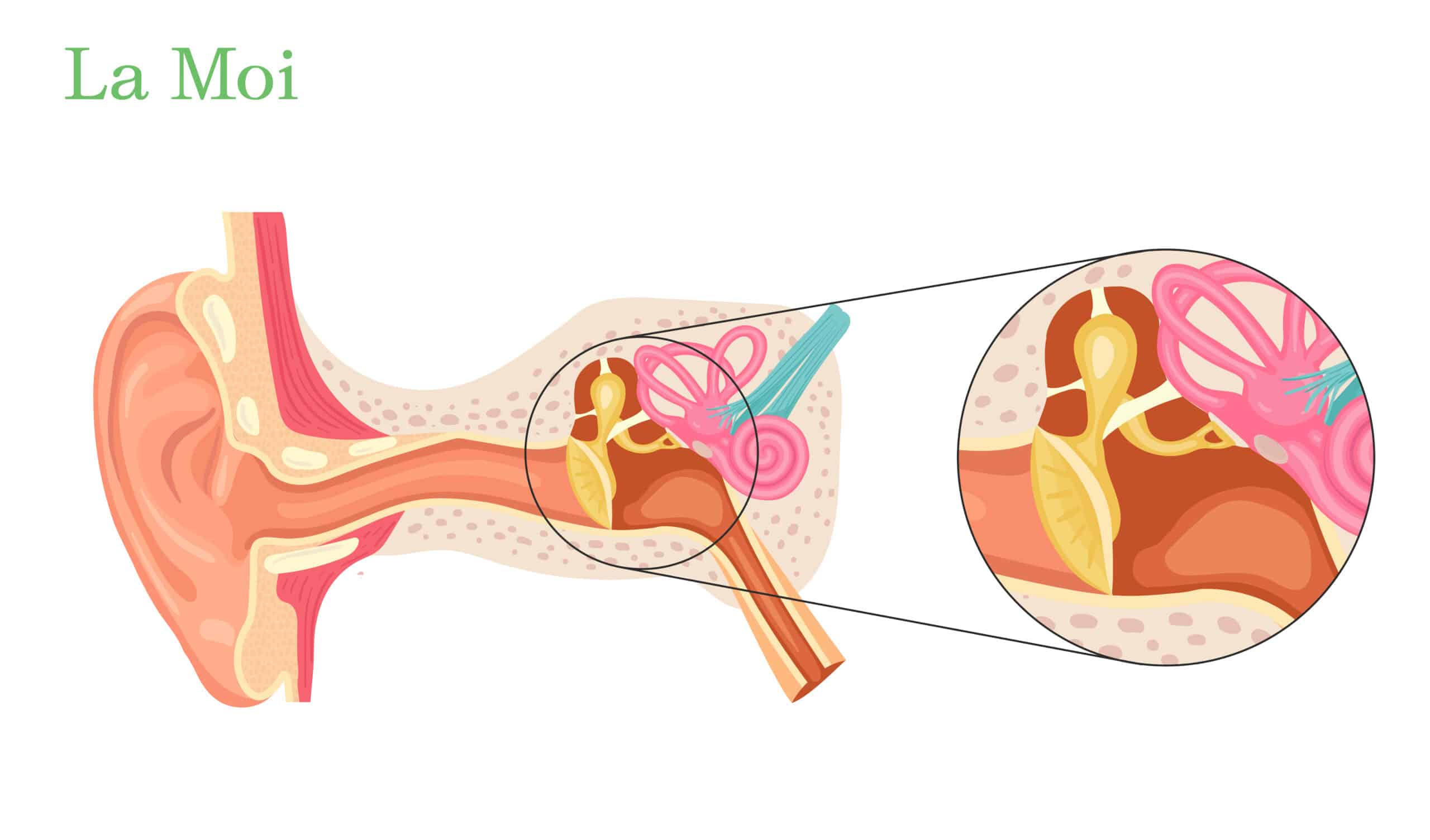 Viêm ta giữa là gì