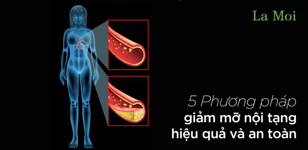 5 Phương pháp giảm mỡ nội tạng hiệu quả và an toàn