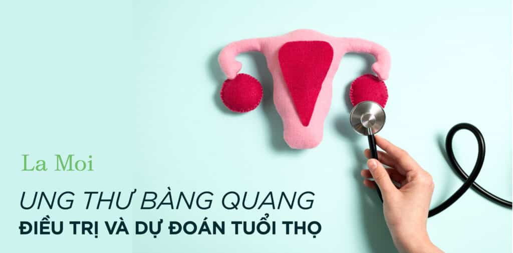 Ung thư bàng quang: Điều trị và dự đoán tuổi thọ