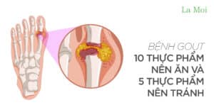 Bệnh Gout: 10 thực phẩm nên ăn và 5 thực phẩm nên tránh