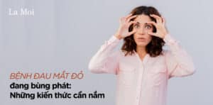 Bệnh đau mắt đỏ đang bùng phát: Những kiến thức cần nắm