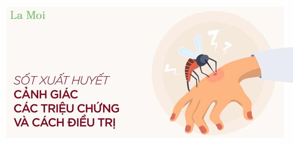 Sốt xuất huyết: Cảnh giác các triệu chứng và cách điều trị