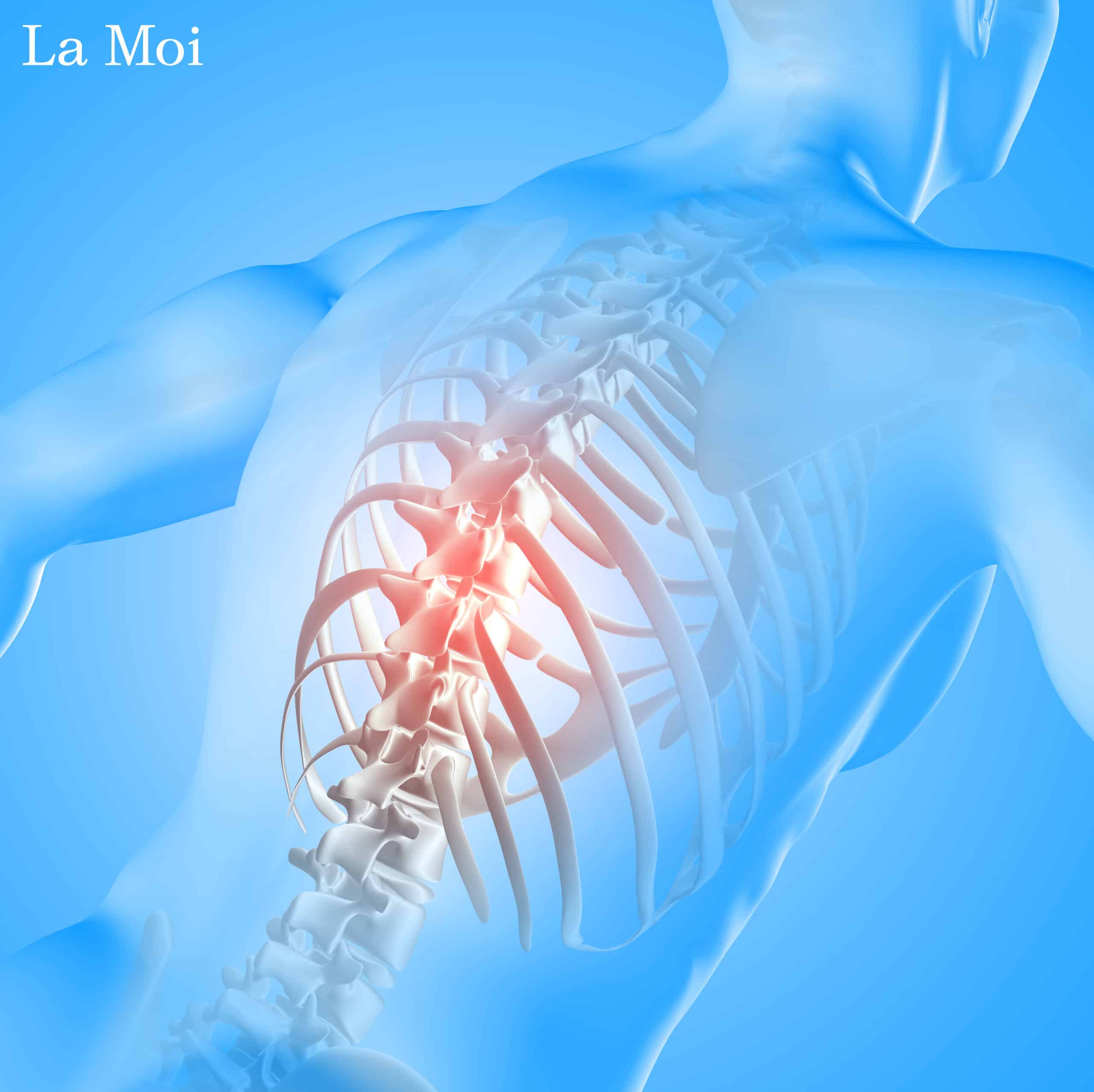 Đau dây thần kinh liên sườn là gì?